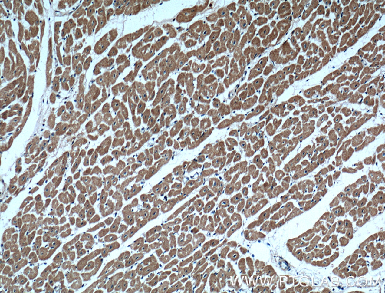 Immunohistochemistry (IHC) staining of human heart tissue using UBE2O Polyclonal antibody (15812-1-AP)