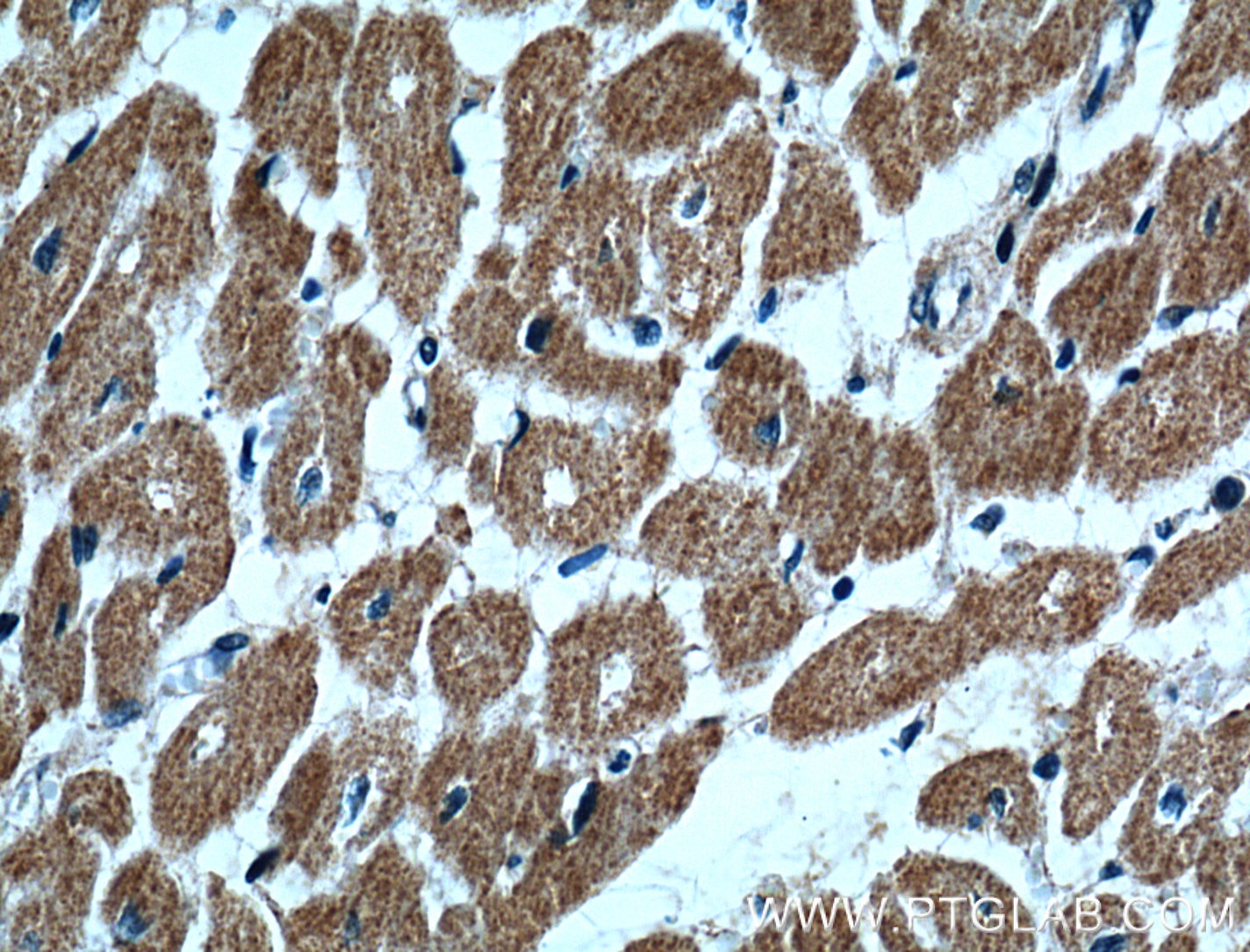 Immunohistochemistry (IHC) staining of human heart tissue using UBE2O Polyclonal antibody (15812-1-AP)