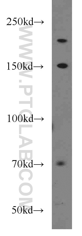 Western Blot (WB) analysis of HeLa cells using UBE2O Polyclonal antibody (15812-1-AP)