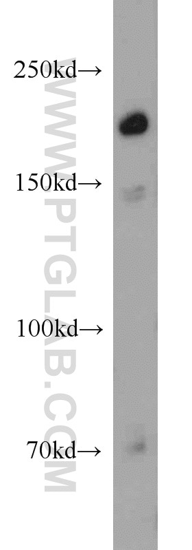 Western Blot (WB) analysis of A431 cells using UBE2O Polyclonal antibody (15812-1-AP)