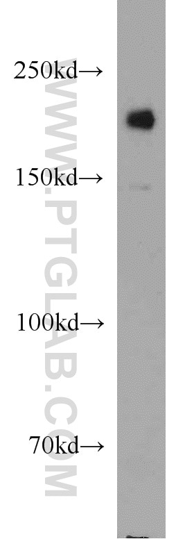 Western Blot (WB) analysis of Jurkat cells using UBE2O Polyclonal antibody (15812-1-AP)