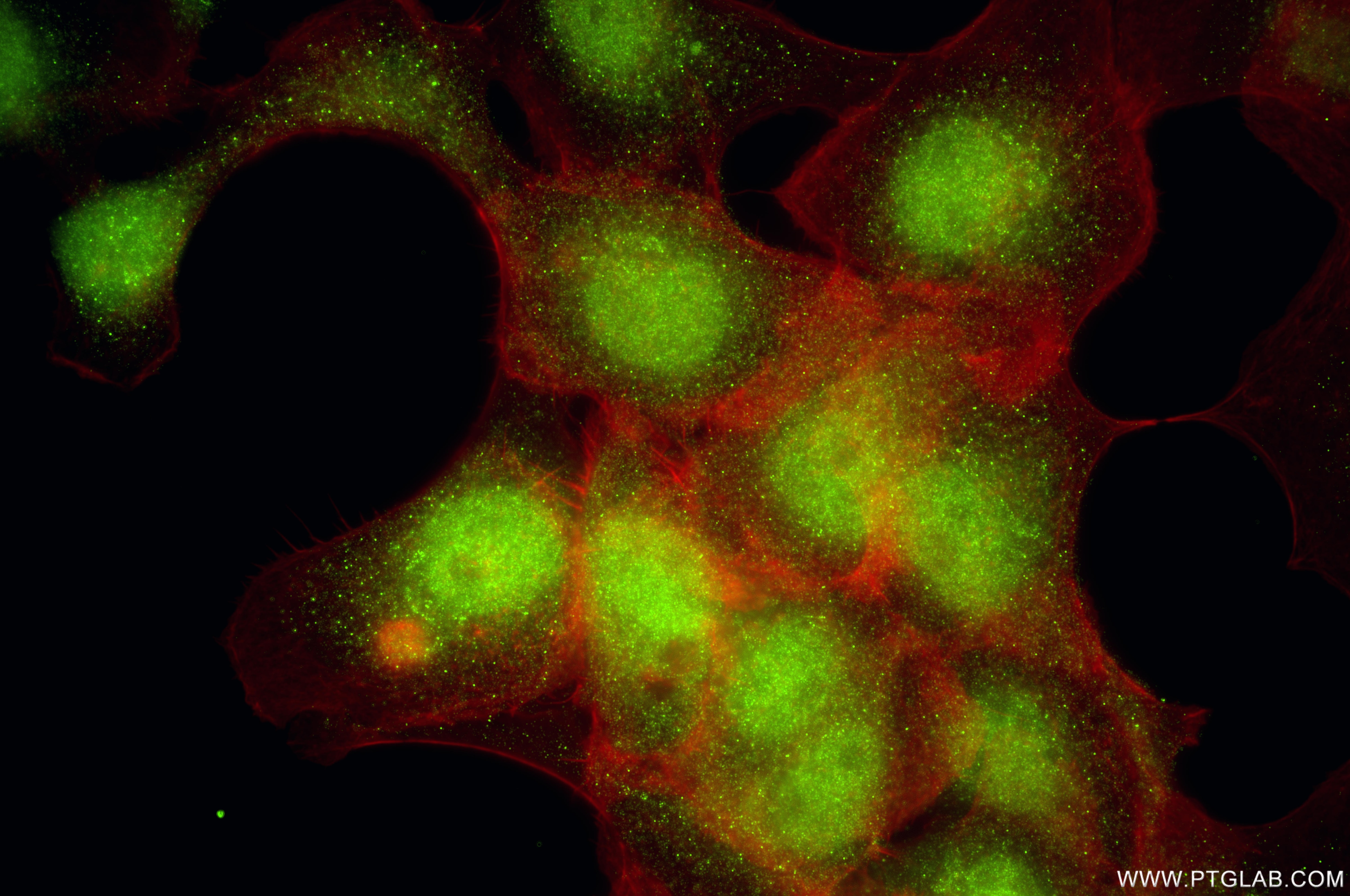 Immunofluorescence (IF) / fluorescent staining of A431 cells using UBE2O Recombinant monoclonal antibody (87282-1-RR)