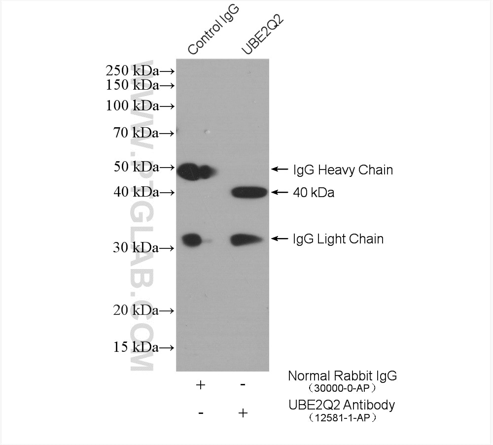 Immunoprecipitation (IP) experiment of HEK-293T cells using UBE2Q2 Polyclonal antibody (12581-1-AP)