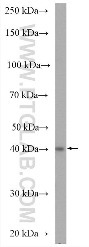 Western Blot (WB) analysis of HEK-293T cells using UBE2Q2 Polyclonal antibody (12581-1-AP)