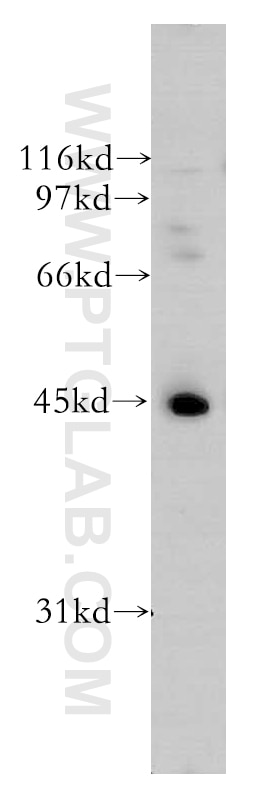 Western Blot (WB) analysis of A431 cells using UBE2Q2 Polyclonal antibody (12581-1-AP)