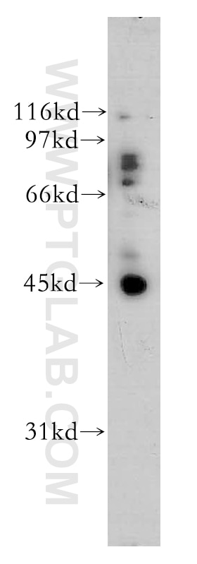 Western Blot (WB) analysis of mouse ovary tissue using UBE2Q2 Polyclonal antibody (12581-1-AP)