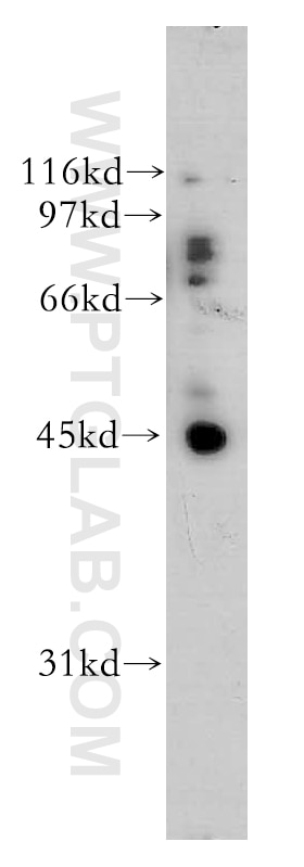 WB analysis of mouse ovary using 12581-1-AP