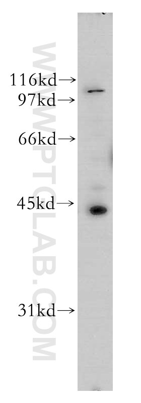 Western Blot (WB) analysis of A431 cells using UBE2Q2 Polyclonal antibody (12581-1-AP)