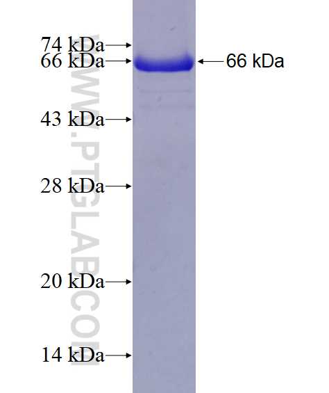 UBE2Q2 fusion protein Ag3276 SDS-PAGE