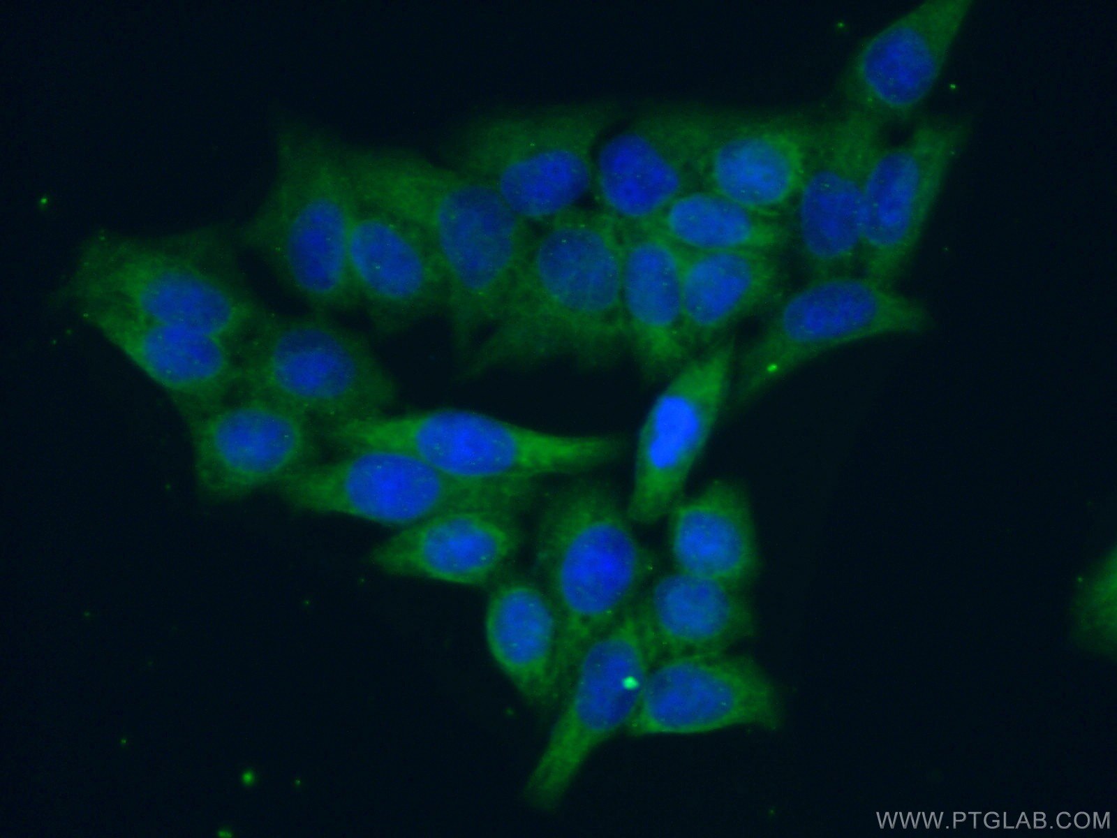 Immunofluorescence (IF) / fluorescent staining of HeLa cells using UBE2R2 Polyclonal antibody (14077-1-AP)