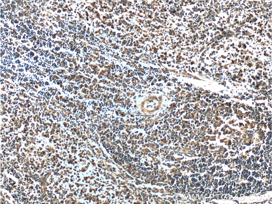 Immunohistochemistry (IHC) staining of human spleen tissue using UBE2R2 Polyclonal antibody (14077-1-AP)