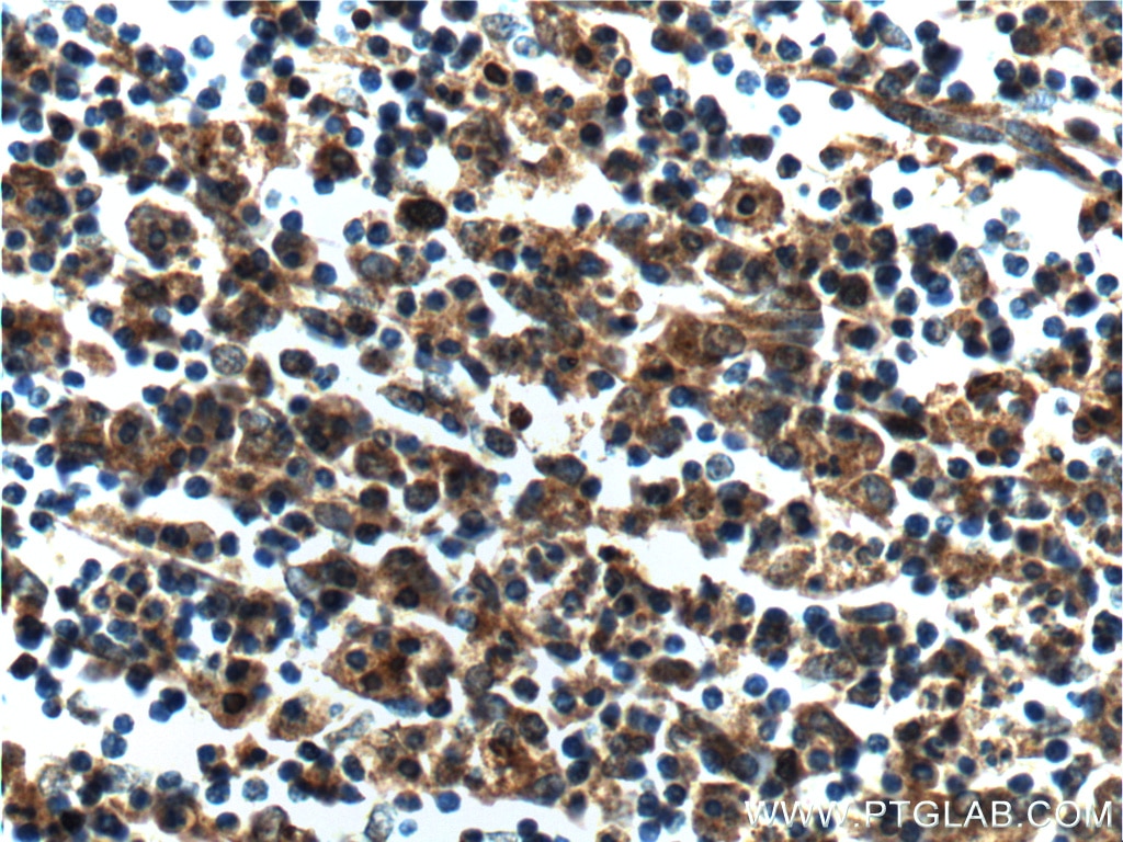 Immunohistochemistry (IHC) staining of human spleen tissue using UBE2R2 Polyclonal antibody (14077-1-AP)