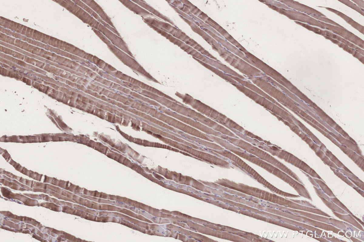 Immunohistochemistry (IHC) staining of mouse skeletal muscle tissue using UBE2R2 Polyclonal antibody (14077-1-AP)