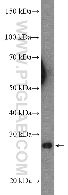 WB analysis of HeLa using 14077-1-AP