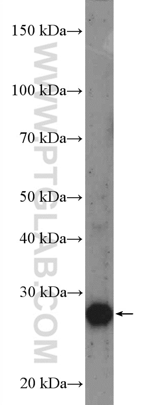 Western Blot (WB) analysis of Jurkat cells using UBE2R2 Polyclonal antibody (14077-1-AP)