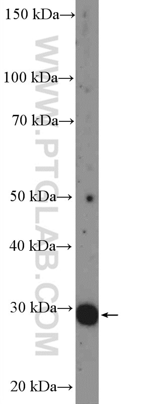 Western Blot (WB) analysis of mouse spleen tissue using UBE2R2 Polyclonal antibody (14077-1-AP)