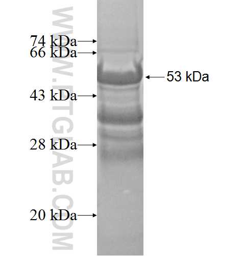 UBE2R2 fusion protein Ag5202 SDS-PAGE