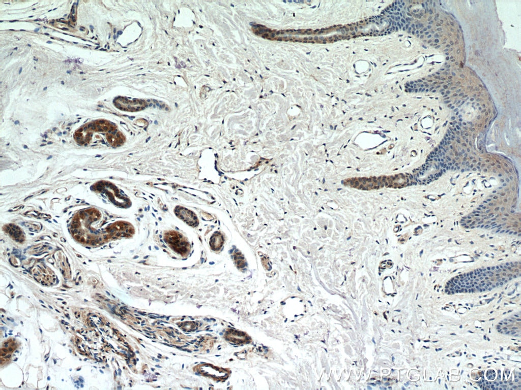 Immunohistochemistry (IHC) staining of human skin tissue using UBE2S Polyclonal antibody (14115-1-AP)