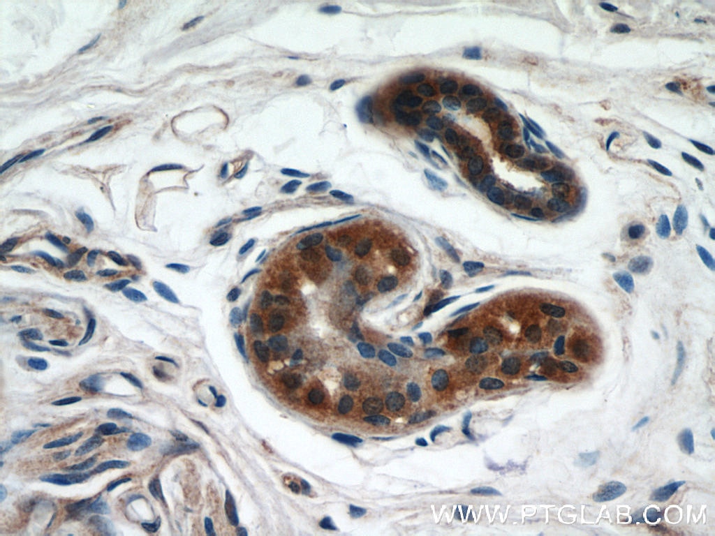 Immunohistochemistry (IHC) staining of human skin tissue using UBE2S Polyclonal antibody (14115-1-AP)