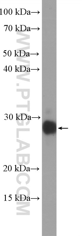 Western Blot (WB) analysis of MCF-7 cells using UBE2S Polyclonal antibody (14115-1-AP)
