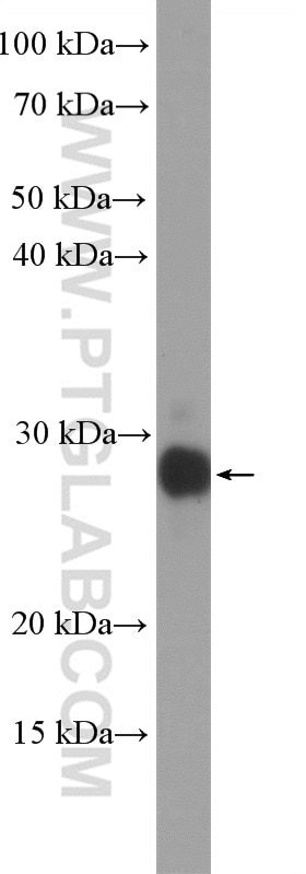 WB analysis of MCF-7 using 14115-1-AP
