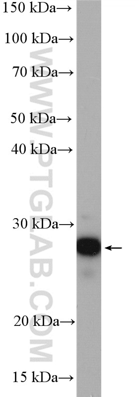 Western Blot (WB) analysis of HeLa cells using UBE2S Polyclonal antibody (14115-1-AP)