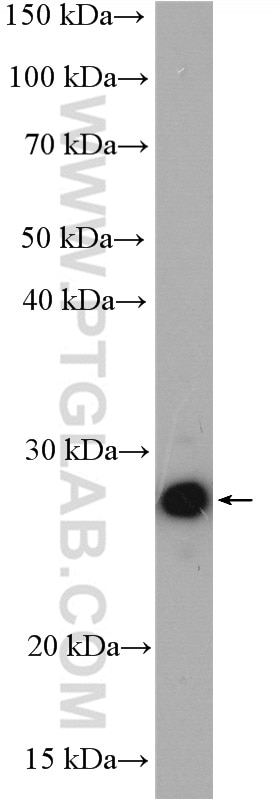 Western Blot (WB) analysis of HEK-293T cells using UBE2S Polyclonal antibody (14115-1-AP)