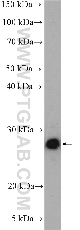 WB analysis of HEK-293T using 14115-1-AP