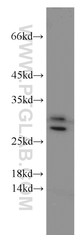 Western Blot (WB) analysis of mouse liver tissue using UBE2S Polyclonal antibody (14115-1-AP)