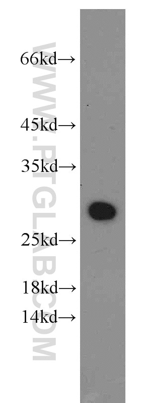 Western Blot (WB) analysis of A2780 cells using UBE2S Polyclonal antibody (14115-1-AP)
