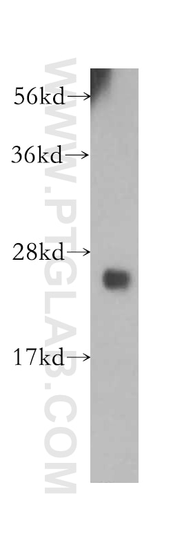 Western Blot (WB) analysis of human liver tissue using UBE2S Polyclonal antibody (14115-1-AP)