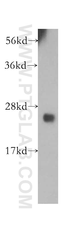 WB analysis of human liver using 14115-1-AP