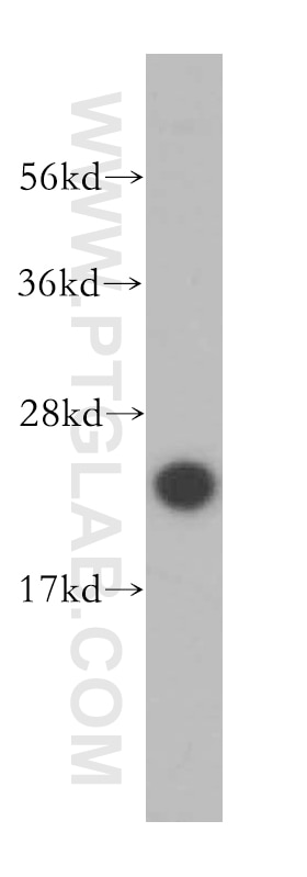 Western Blot (WB) analysis of MDA-MB-453s cells using UBE2S Polyclonal antibody (14115-1-AP)