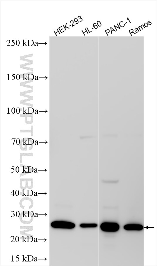 WB analysis using 18219-1-AP Western Blot (WB) analysis of various lysates using UBE2S Polyclonal antibody (18219-1-AP)