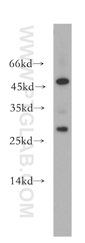 Western Blot (WB) analysis of COLO 320 cells using UBE2S Polyclonal antibody (18219-1-AP)