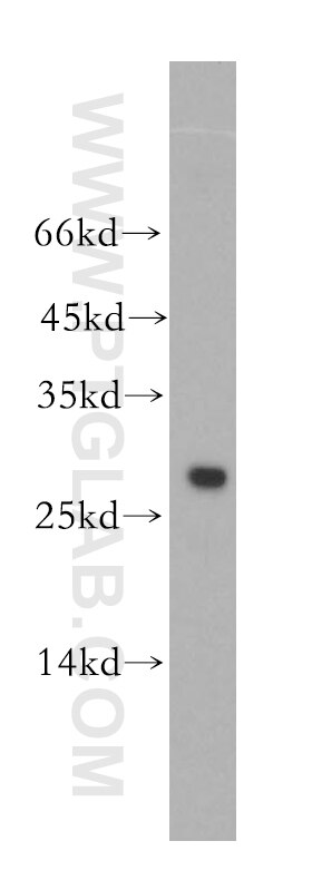 Western Blot (WB) analysis of HL-60 cells using UBE2S Polyclonal antibody (18219-1-AP)