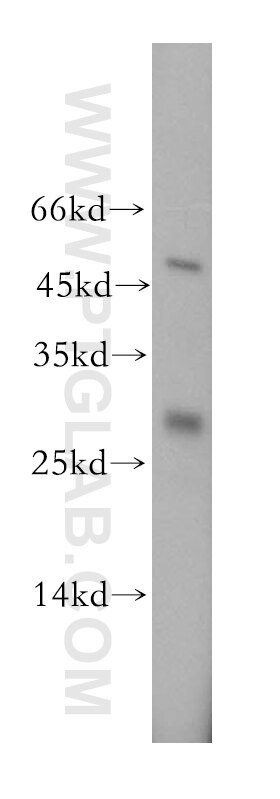 Western Blot (WB) analysis of MCF-7 cells using UBE2S Polyclonal antibody (18219-1-AP)