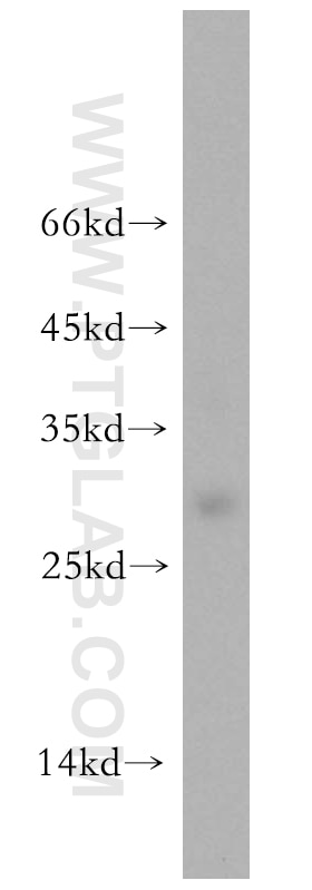 Western Blot (WB) analysis of MDA-MB-453s cells using UBE2S Polyclonal antibody (18219-1-AP)