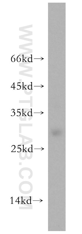 WB analysis of MDA-MB-453s using 18219-1-AP