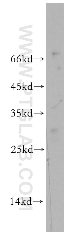 Western Blot (WB) analysis of mouse ovary tissue using UBE2S Polyclonal antibody (18219-1-AP)