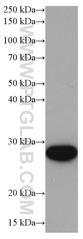 Western Blot (WB) analysis of Jurkat cells using UBE2S Monoclonal antibody (66897-1-Ig)