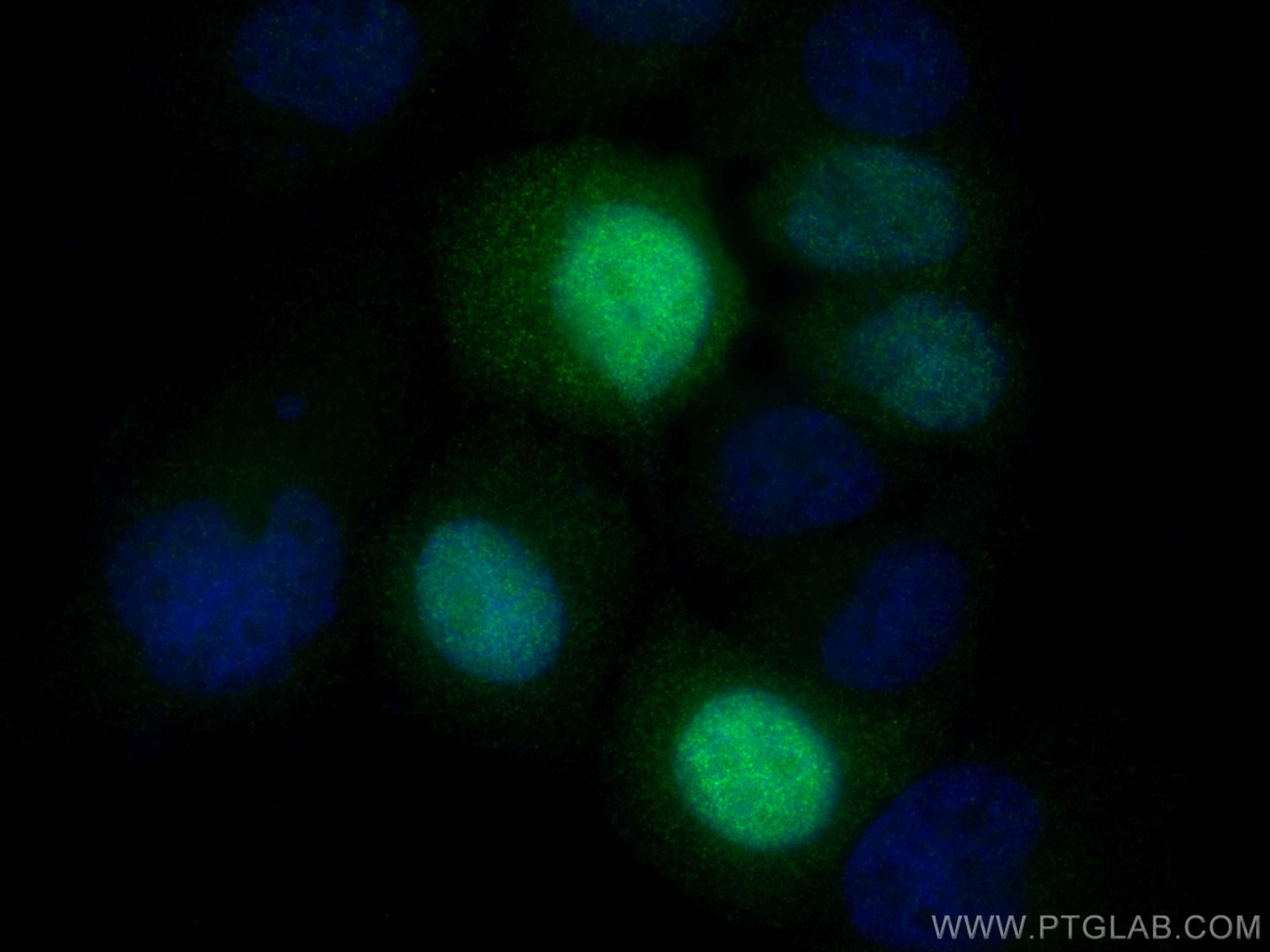 Immunofluorescence (IF) / fluorescent staining of NCCIT cells using UBE2S Recombinant antibody (81854-1-RR)