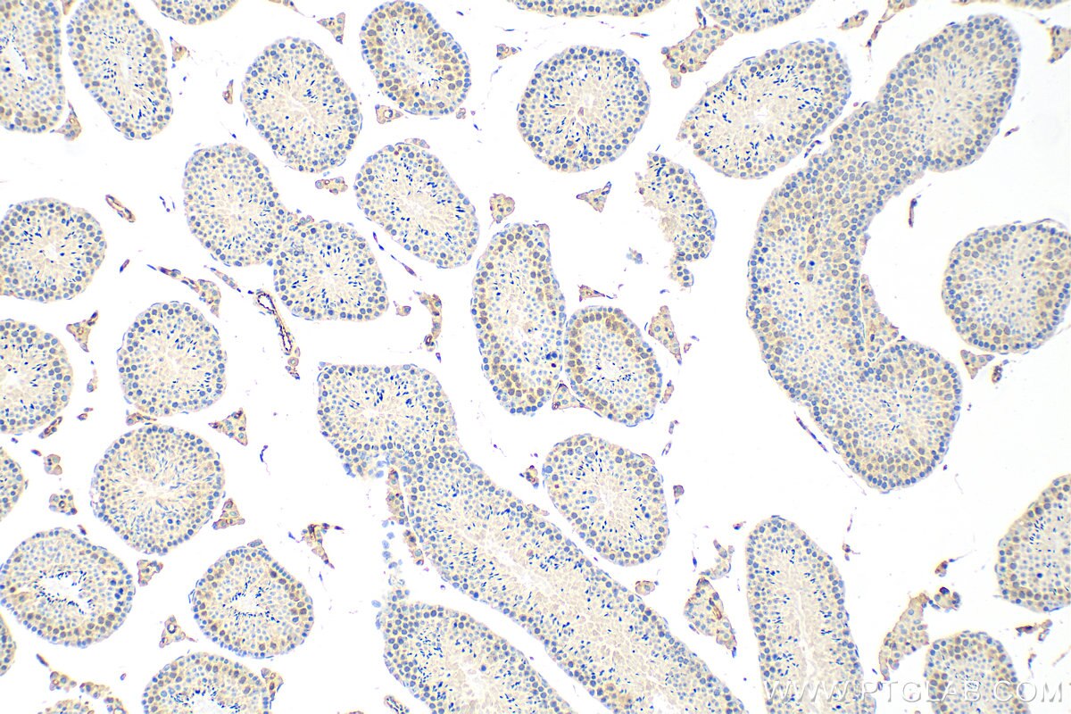 Immunohistochemistry (IHC) staining of mouse testis tissue using UBE2S Recombinant antibody (81854-1-RR)