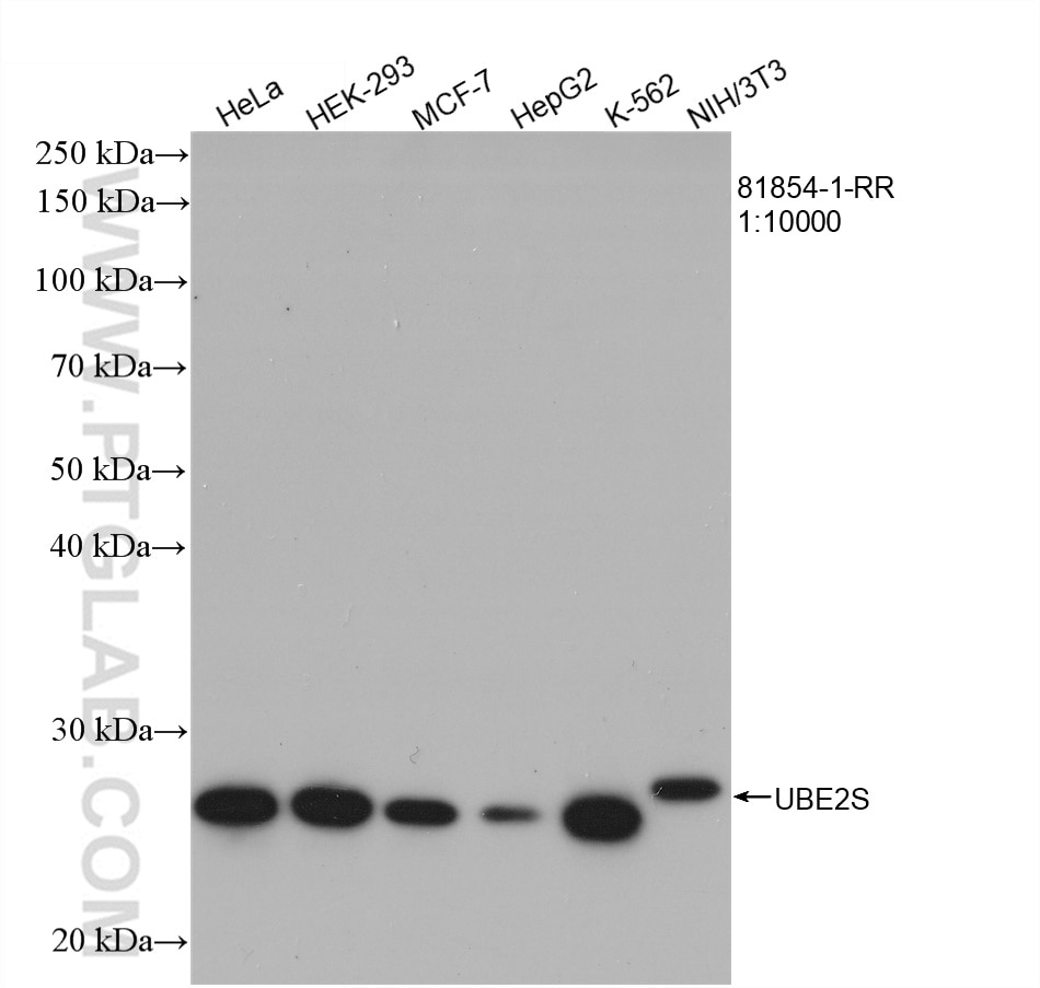 Western Blot (WB) analysis of various lysates using UBE2S Recombinant antibody (81854-1-RR)