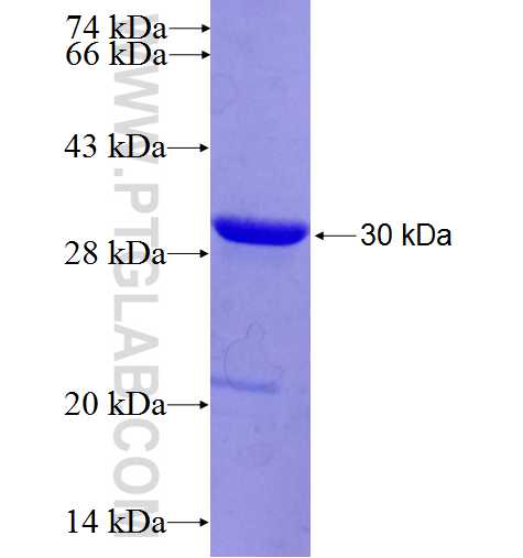 UBE2S fusion protein Ag5378 SDS-PAGE