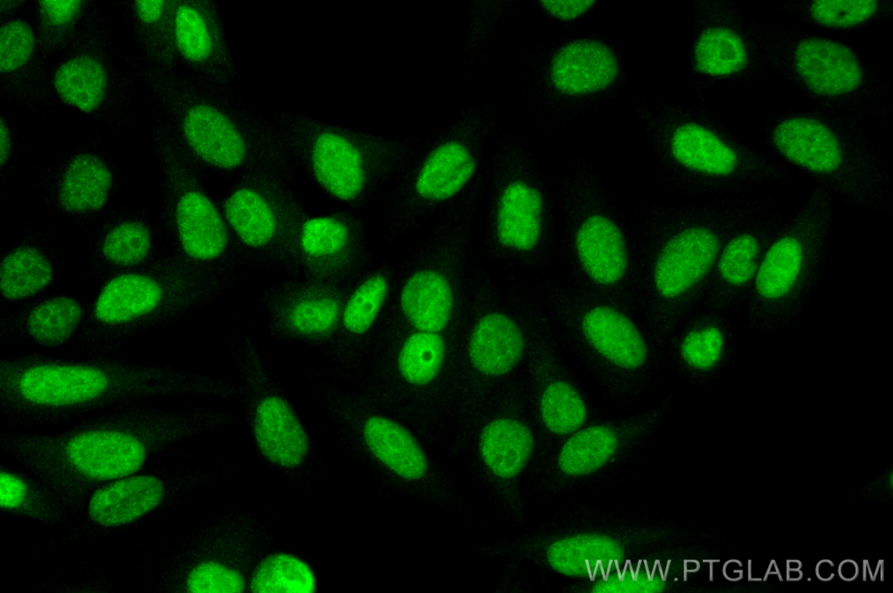 Immunofluorescence (IF) / fluorescent staining of HepG2 cells using UBE2T/HSPC150 Polyclonal antibody (10105-2-AP)