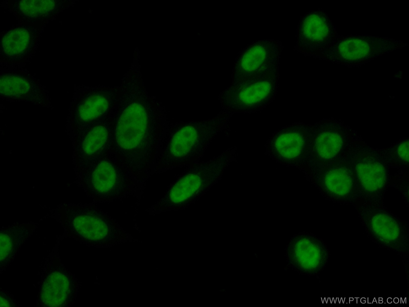 Immunofluorescence (IF) / fluorescent staining of HeLa cells using UBE2T/HSPC150 Polyclonal antibody (10105-2-AP)