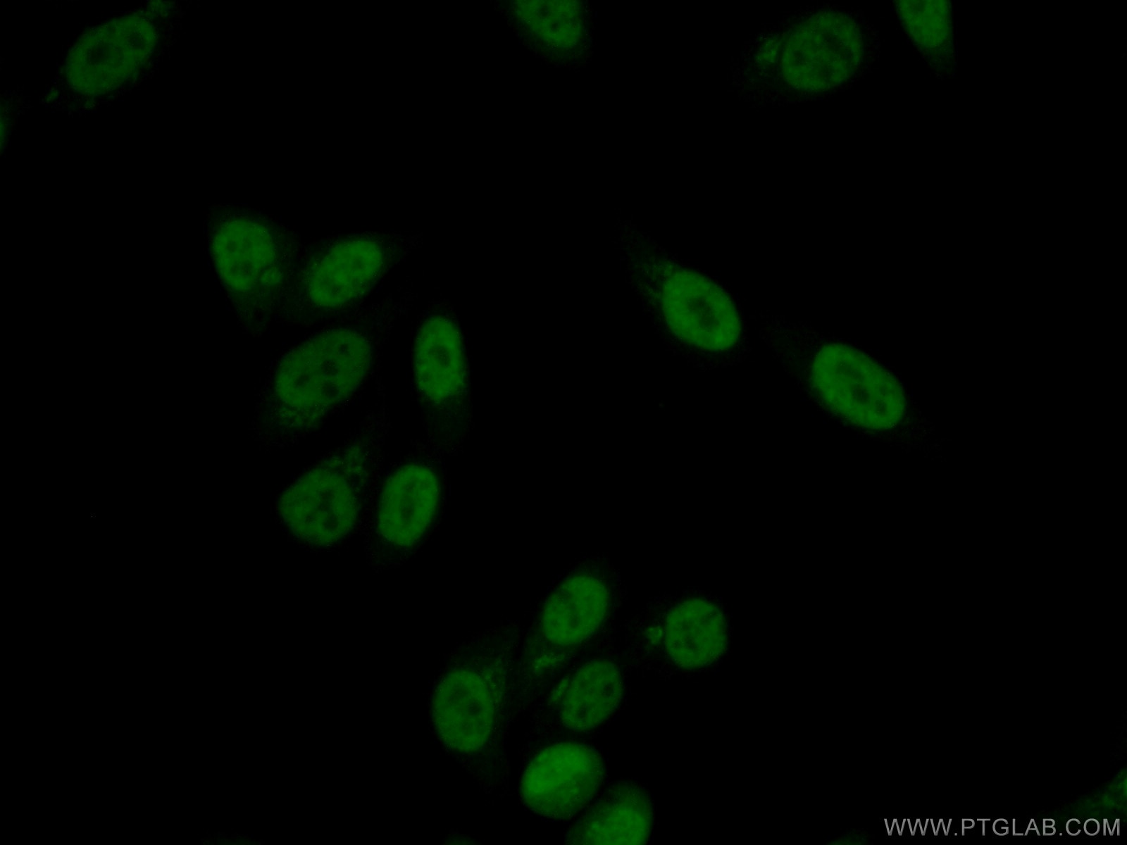 Immunofluorescence (IF) / fluorescent staining of HepG2 cells using UBE2T/HSPC150 Polyclonal antibody (10105-2-AP)