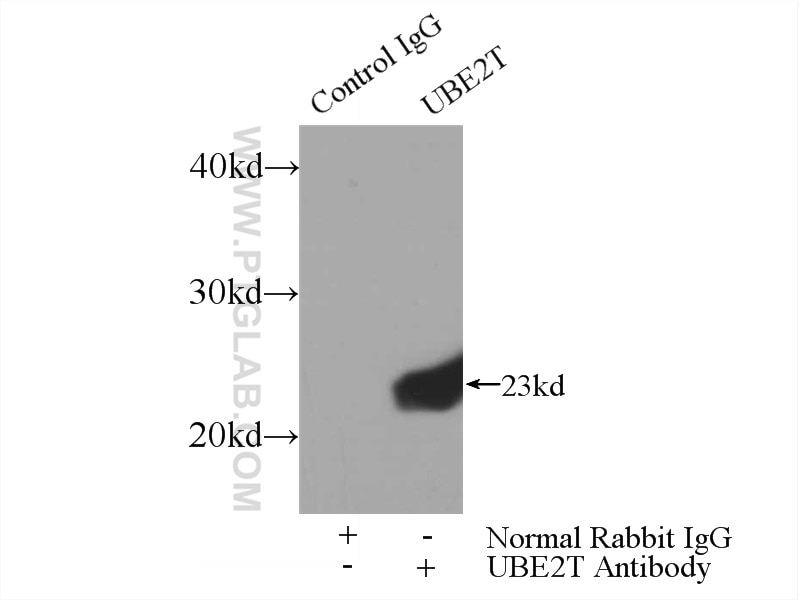 Immunoprecipitation (IP) experiment of HeLa cells using UBE2T/HSPC150 Polyclonal antibody (10105-2-AP)