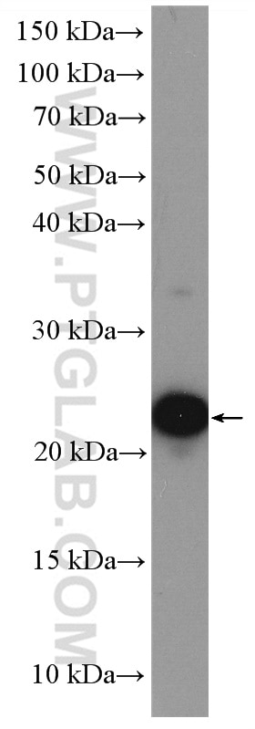 Western Blot (WB) analysis of HeLa cells using UBE2T/HSPC150 Polyclonal antibody (10105-2-AP)